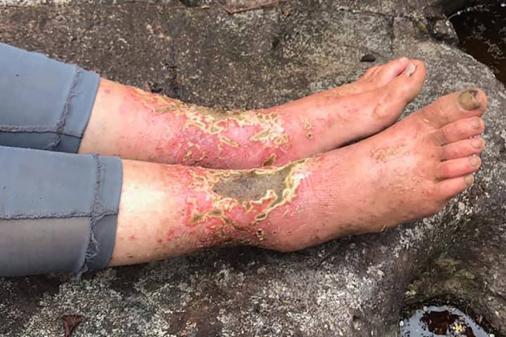 Amanda Eller lost hiker Hawaii survival shtf preparedness search rescue 4