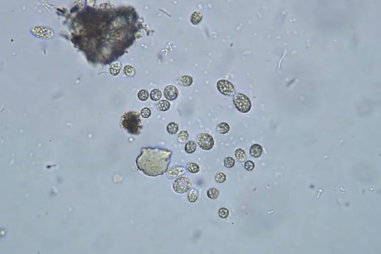 Video: LifeStraw Tested Under a Microscope