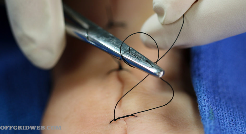 how to suture