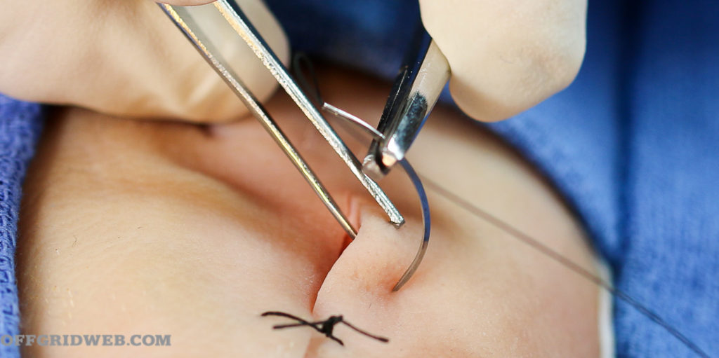 how to suture 1