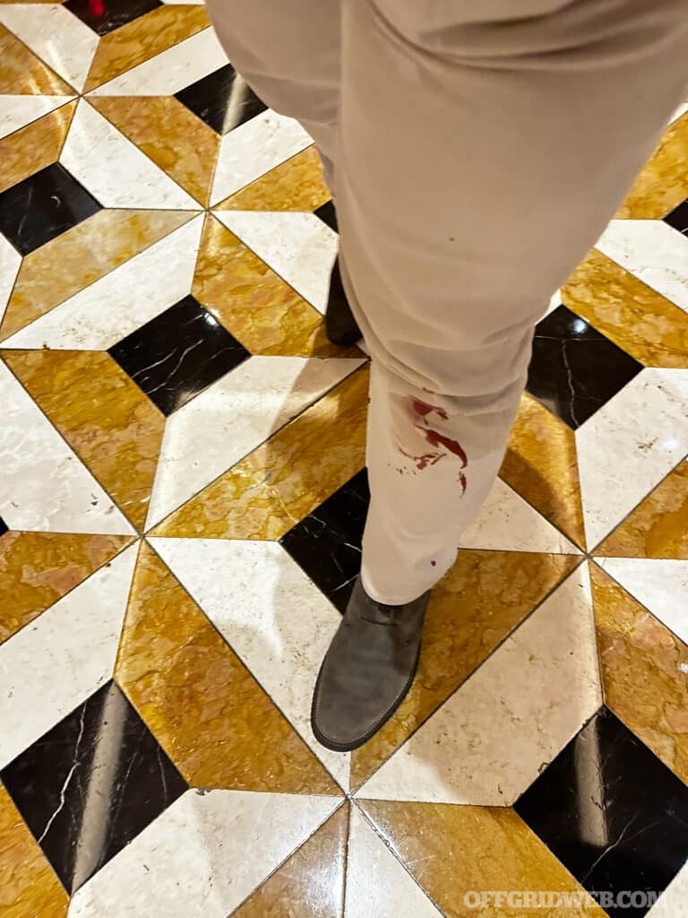 blood on mans pants after knife fight